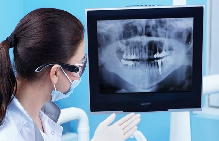 Dental X-Rays In General Dentistry