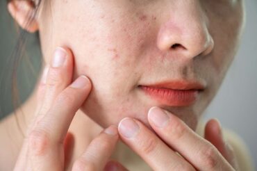 Skin Tone and Texture